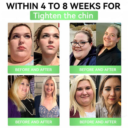 Moringa × Berberine × AMPK Slimming & Metabolic Nano Microneedle Patch | Daily support for metabolism and heart health