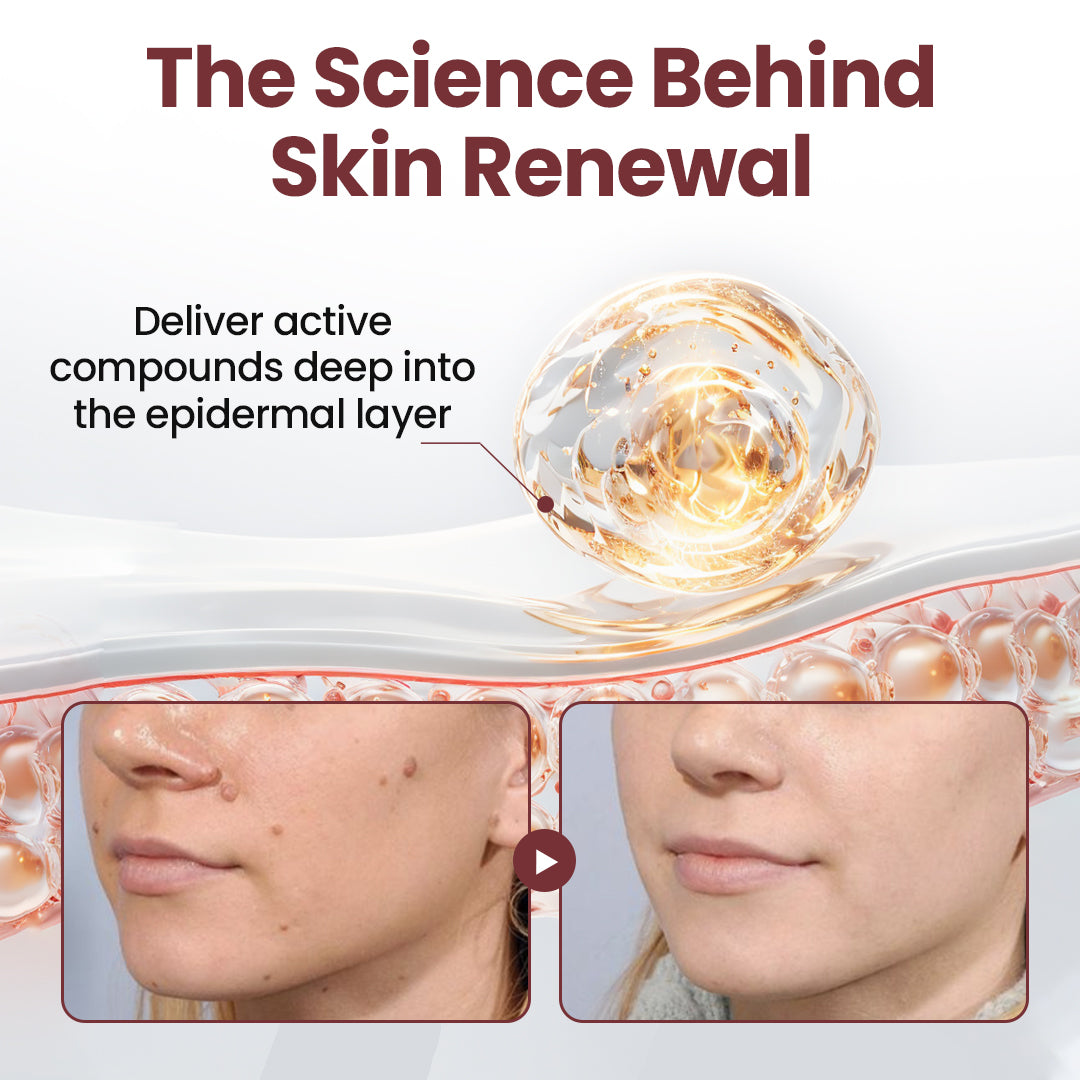 ✅Flash Sale - Action Renewal Cream