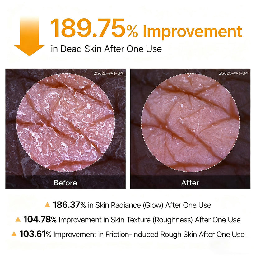 Peel Shot - Kojic + Turmeric Body Peel Spray